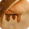 Mastitis
